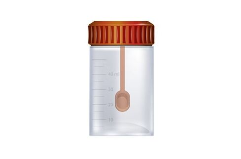 fecal collection container for pest analysis