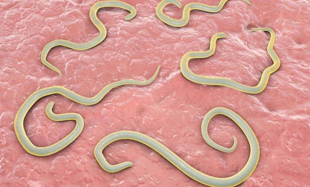 Worms in the human body