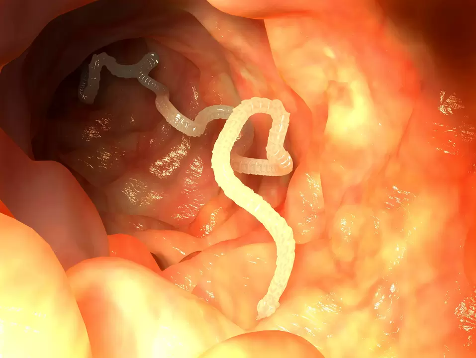 parasitic worm of human esophagus