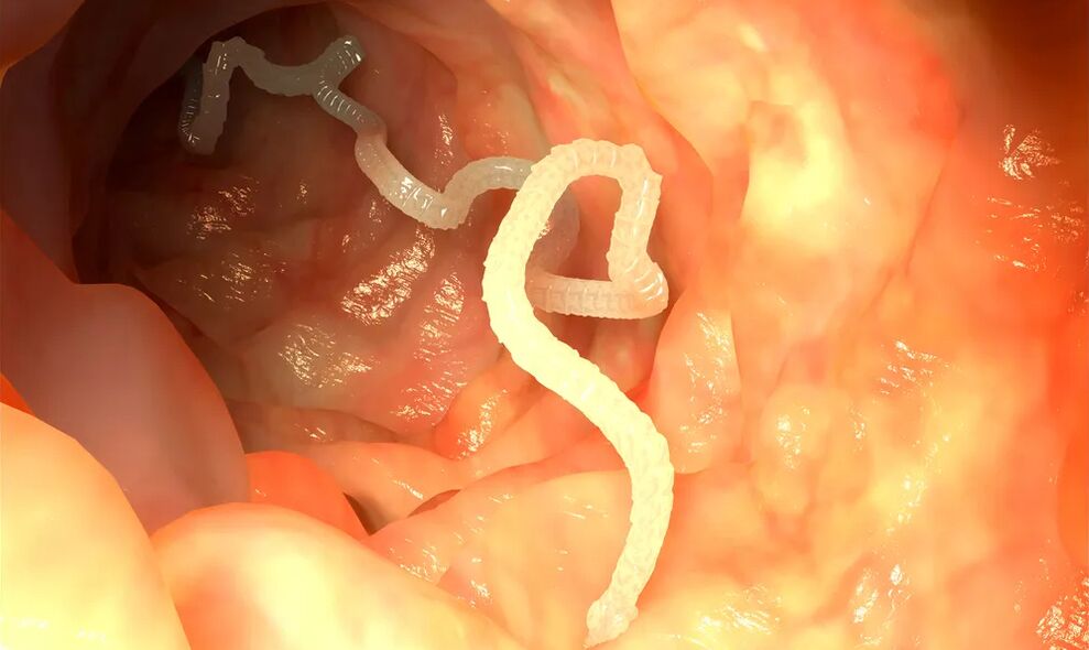 Lume worms infect the intestines