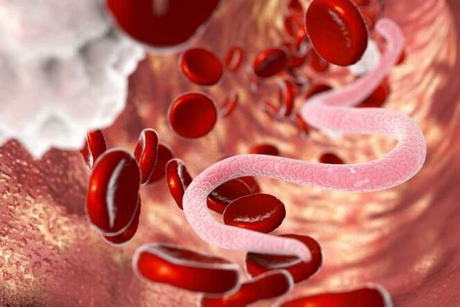 Analyzes to determine helminth